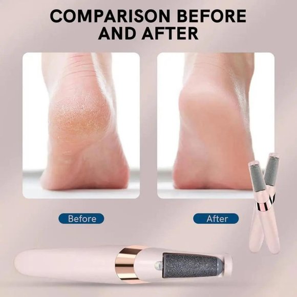 Foot Grinder Professional Electric Pedicure Tool USB Rechargeable File Callus - Picture 10 of 12